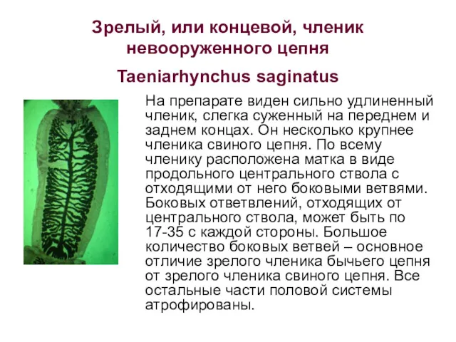 Зрелый, или концевой, членик невооруженного цепня Taeniarhynchus saginatus На препарате
