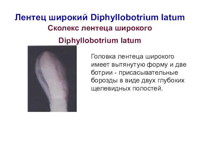 Лентец широкий Diphyllobotrium latum Сколекс лентеца широкого Diphyllobotrium latum Головка