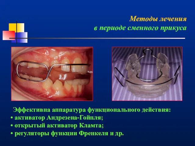 Методы лечения в периоде сменного прикуса Эффективна аппаратура функционального действия: