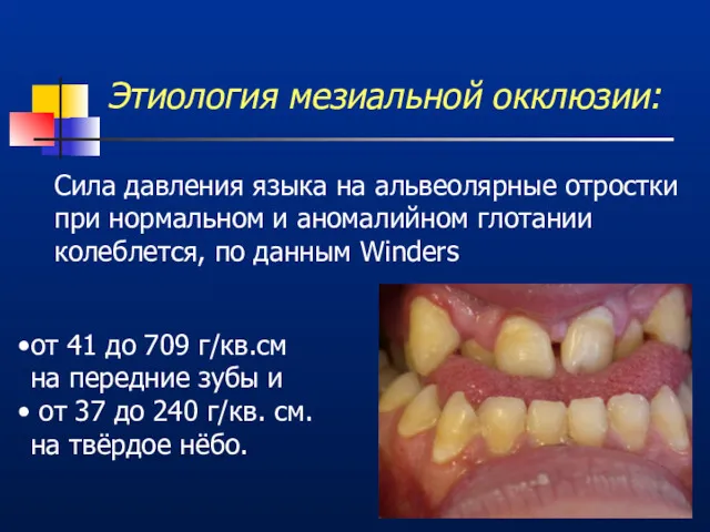 Этиология мезиальной окклюзии: Сила давления языка на альвеолярные отростки при