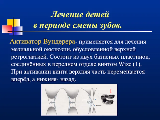 Лечение детей в периоде смены зубов. Активатор Вундерера- применяется для