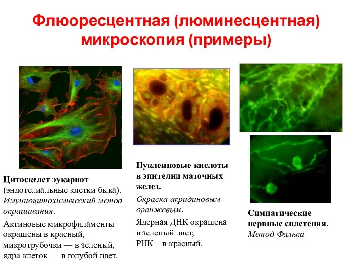 Флюоресцентная (люминесцентная) микроскопия (примеры) Цитоскелет эукариот (эндотелиальные клетки быка). Имунноцитохимический