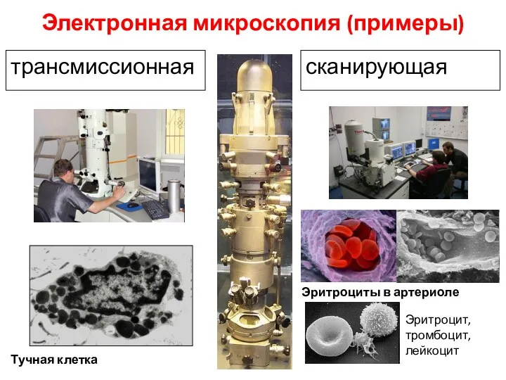 Электронная микроскопия (примеры) трансмиссионная сканирующая Тучная клетка Эритроциты в артериоле