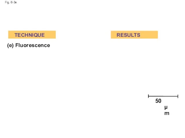 Fig. 6-3e (e) Fluorescence TECHNIQUE RESULTS 50 µm