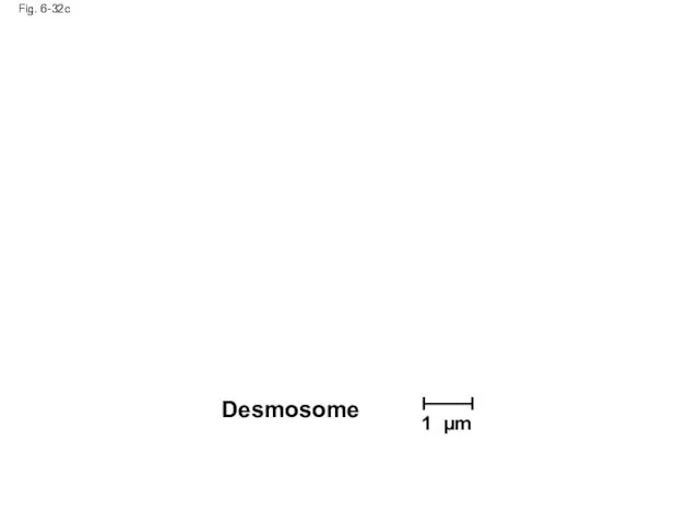 Fig. 6-32c Desmosome 1 µm