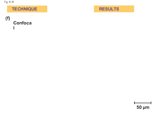 Fig. 6-3f (f) Confocal TECHNIQUE RESULTS 50 µm