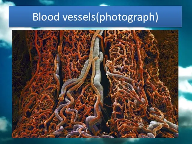 Blood vessels(photograph)