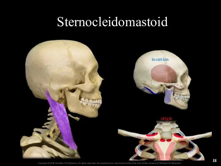 Sternocleidomastoid origin insertion