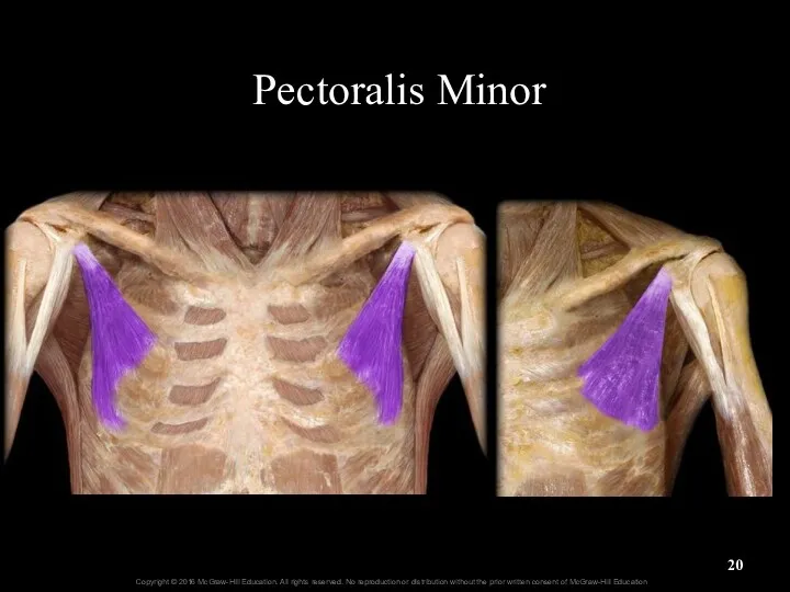 Pectoralis Minor