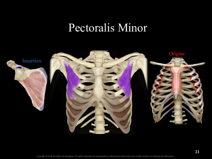 Pectoralis Minor Insertion Origins