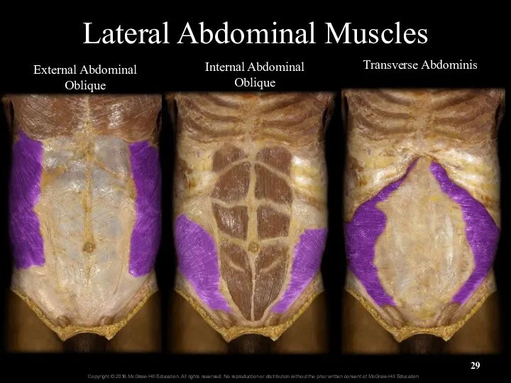 Lateral Abdominal Muscles External Abdominal Oblique Internal Abdominal Oblique Transverse Abdominis