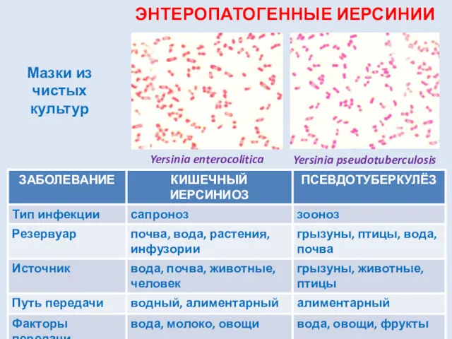 Yersinia enterocolitica Yersinia pseudotuberculosis ЭНТЕРОПАТОГЕННЫЕ ИЕРСИНИИ Мазки из чистых культур