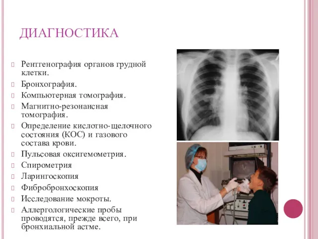 ДИАГНОСТИКА Рентгенография органов грудной клетки. Бронхография. Компьютерная томография. Магнитно-резонансная томография.