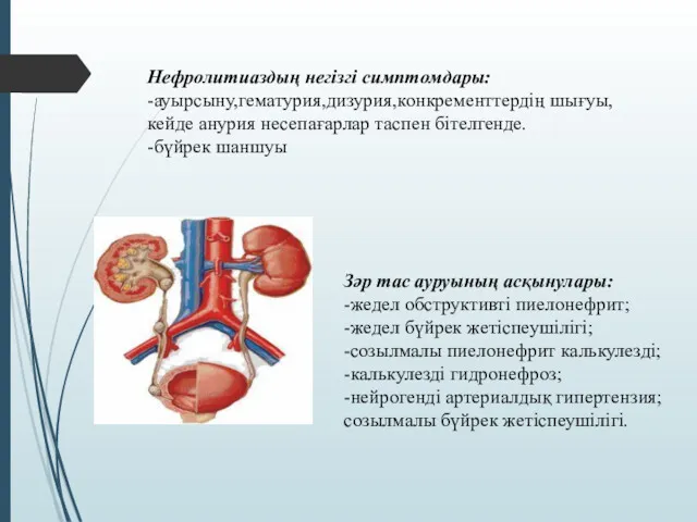 Нефролитиаздың негізгі симптомдары: -ауырсыну,гематурия,дизурия,конкременттердің шығуы,кейде анурия несепағарлар таспен бітелгенде. -бүйрек