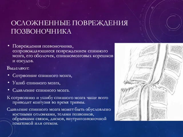 ОСЛОЖНЕННЫЕ ПОВРЕЖДЕНИЯ ПОЗВОНОЧНИКА Повреждения позвоночника, сопровождающиеся повреждением спинного мозга, его