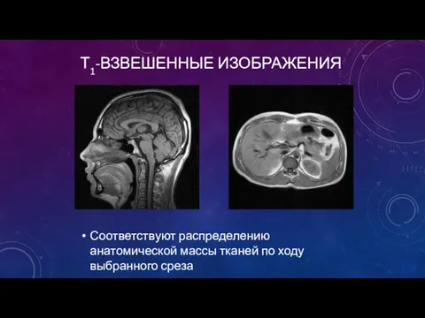 Т1-ВЗВЕШЕННЫЕ ИЗОБРАЖЕНИЯ Соответствуют распределению анатомической массы тканей по ходу выбранного среза