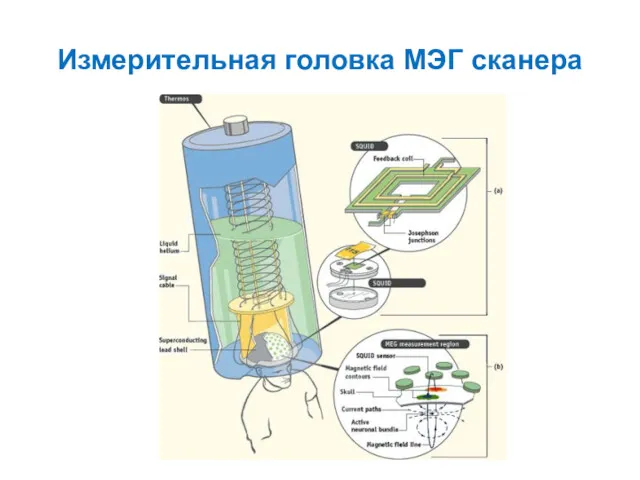 Измерительная головка МЭГ сканера