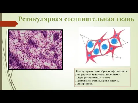 Ретикулярная соединительная ткань Ретикулярная ткань. Срез лимфатического узла (окраска гематоксилин-эозином). 1.Ядра ретикулярных клеток.