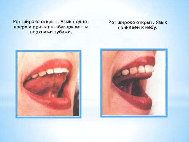 Парус Рот широко открыт. Язык поднят вверх и прижат к