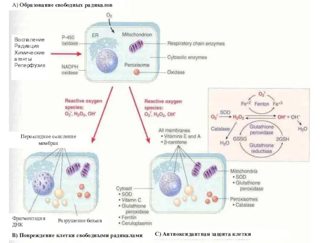 А) Образование свободных радикалов Воспаление Радиация Химические агенты Реперфузия Пероксидное