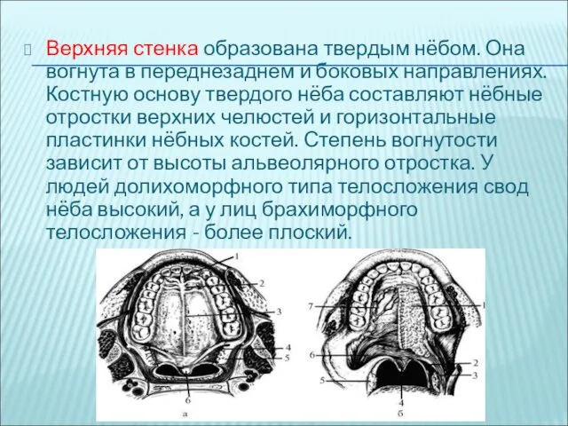 Верхняя стенка образована твердым нёбом. Она вогнута в переднезаднем и