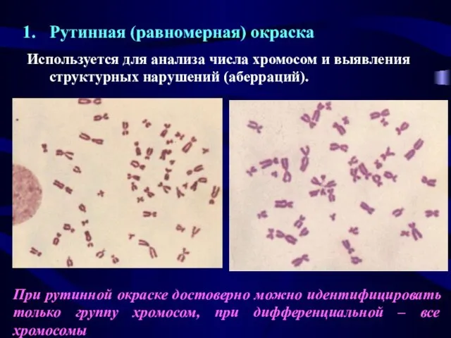 Рутинная (равномерная) окраска Используется для анализа числа хромосом и выявления