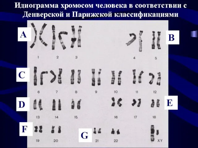 Идиограмма хромосом человека в соответствии с Денверской и Парижской классификациями