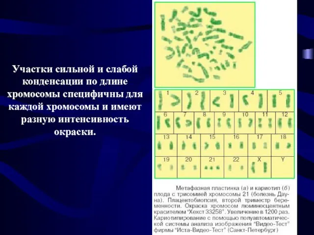 Участки сильной и слабой конденсации по длине хромосомы специфичны для