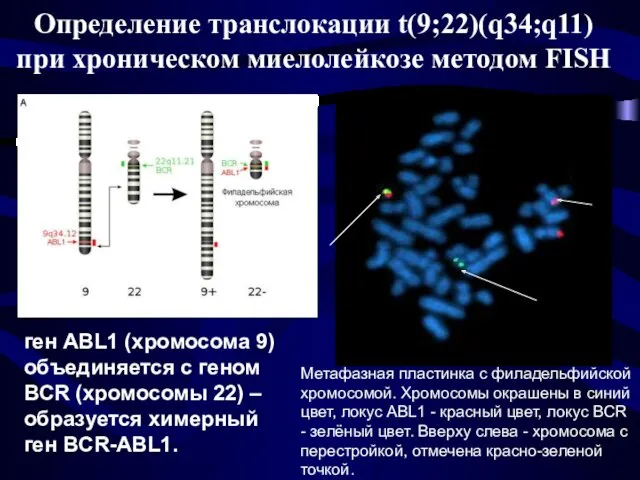 Определение транслокации t(9;22)(q34;q11) при хроническом миелолейкозе методом FISH Метафазная пластинка