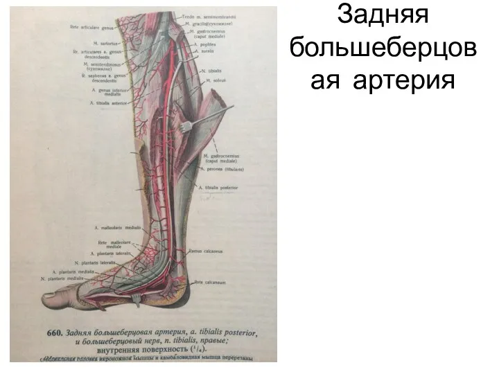 Задняя большеберцовая артерия