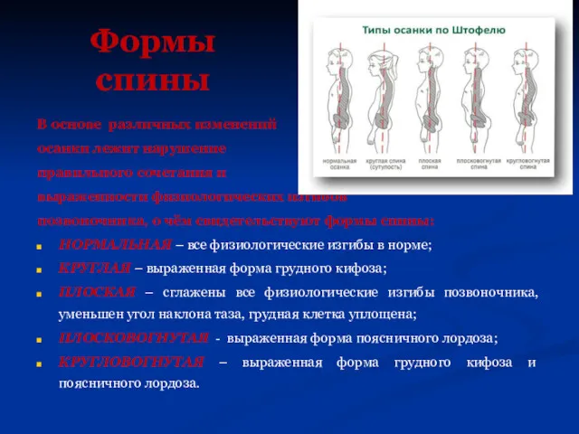 Формы спины В основе различных изменений осанки лежит нарушение правильного