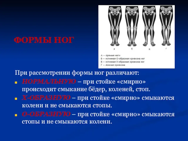 ФОРМЫ НОГ При рассмотрении формы ног различают: НОРМАЛЬНУЮ – при