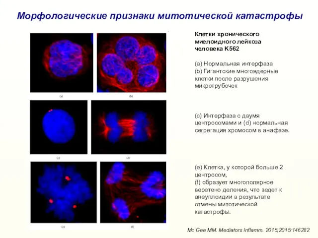 Морфологические признаки митотической катастрофы Клетки хронического миелоидного лейкоза человека K562