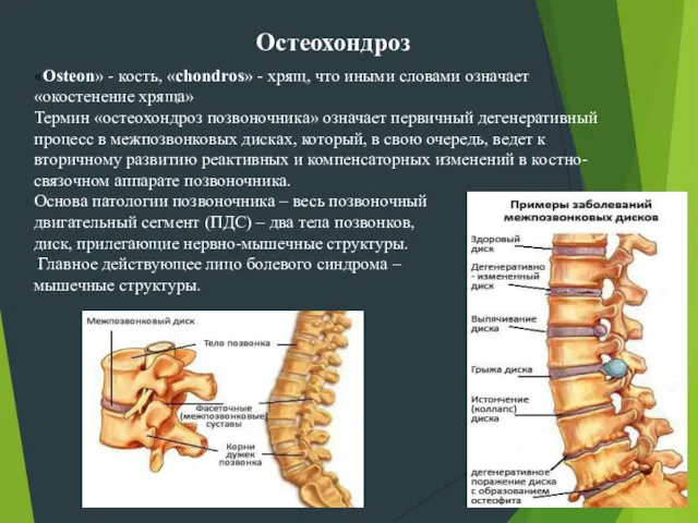 Остеохондроз «Osteon» - кость, «chondros» - хрящ, что иными словами