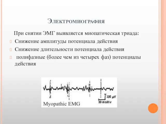 Электромиография При снятии ЭМГ выявляется миопатическая триада: Снижение амплитуды потенциала