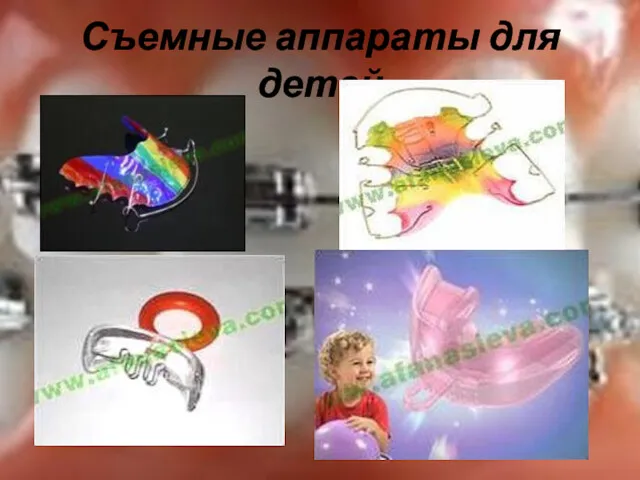 Съемные аппараты для детей