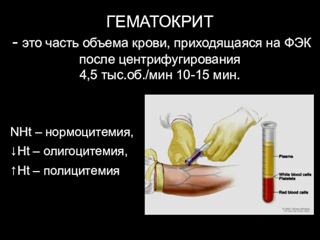 ГЕМАТОКРИТ - это часть объема крови, приходящаяся на ФЭК после центрифугирования 4,5 тыс.об./мин