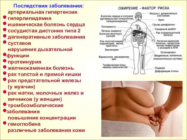 Последствия заболевания: артериальная гипертензия гиперлипидемия ишемическая болезнь сердца сосудистая дистония