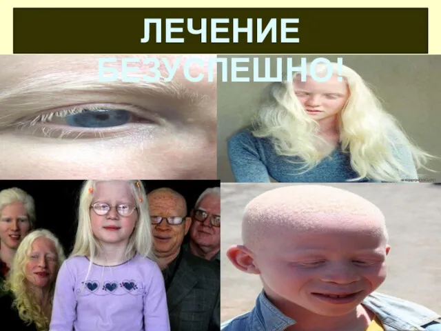 ЛЕЧЕНИЕ БЕЗУСПЕШНО!