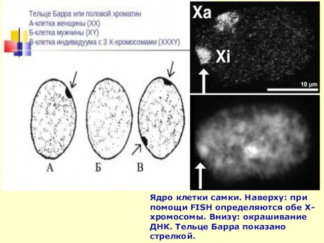 Ядро клетки самки. Наверху: при помощи FISH определяются обе Х-хромосомы.