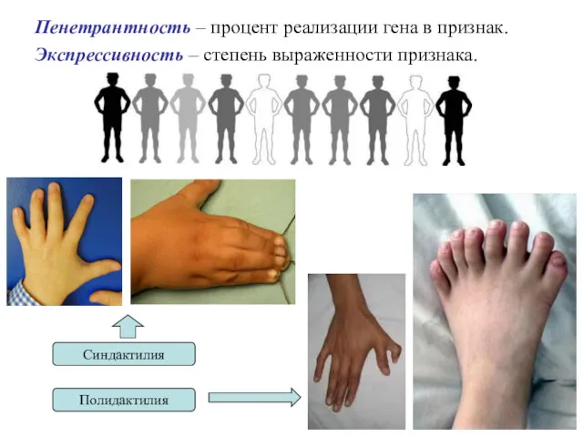 Пенетрантность – процент реализации гена в признак. Экспрессивность – степень выраженности признака. Синдактилия Полидактилия