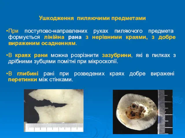 Ушкодження пиляючими предметами При поступово-направлених рухах пиляючого предмета формується лінійна рана з нерівними