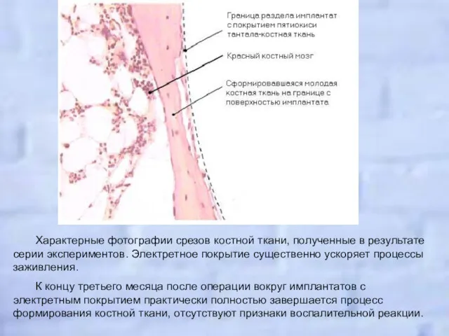 Характерные фотографии срезов костной ткани, полученные в результате серии экспериментов.