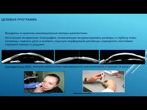 ЦЕЛЕВАЯ ПРОГРАММА Внедрены в практику инновационные методы диагностики: Оптическая когерентная