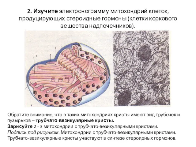 2. Изучите электронограмму митохондрий клеток, продуцирующих стероидные гормоны (клетки коркового