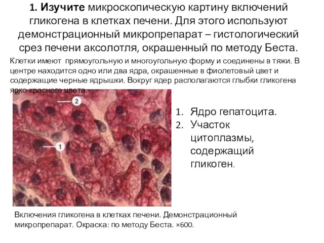 1. Изучите микроскопическую картину включений гликогена в клетках печени. Для