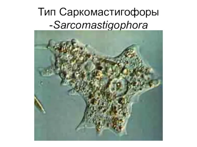 Тип Саркомастигофоры -Sarcomastigophora