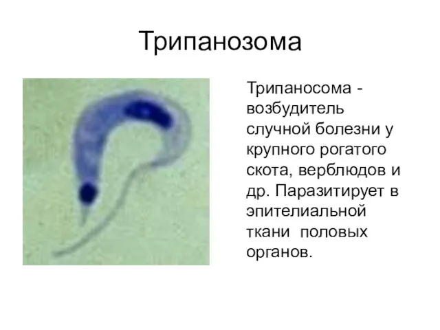 Трипанозома