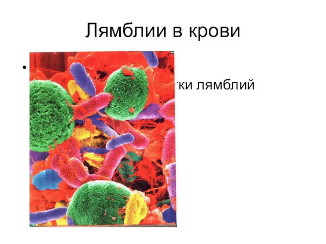 Лямблии в крови Зеленые шарики клетки лямблий