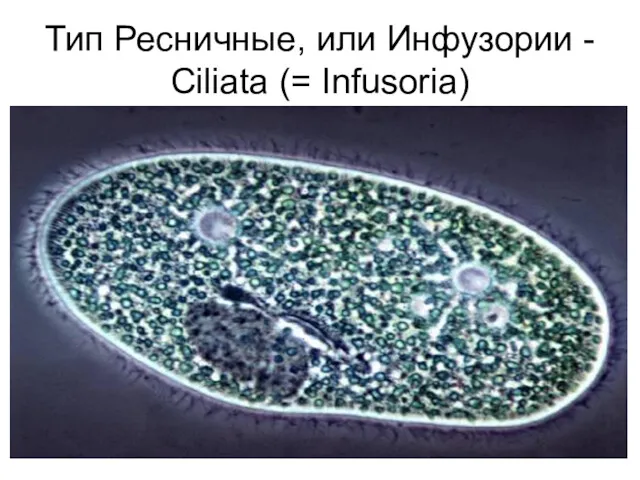 Тип Ресничные, или Инфузории - Ciliata (= Infusoria)